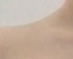 [19] 나 승모근 심한 거임?