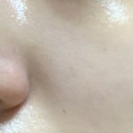 [댓글부탁해] ㅈㅂㅈㅂ 들어와줘 급해ㅜㅜㅜ <b>잡티</b> 어떻게 없애?ㅜㅜ