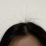 [이것좀봐줘] 머리에 <b>잡초</b> 어카냐ㅅㅂ..