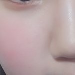 [댓글부탁해] 얘들아 나 피부 두부같이 짱좋지않냥ㅎㅎㅎㅎ