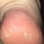 얘들아 내 <b>발꿈치</b> 왜 이래??