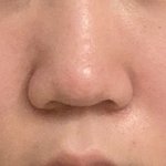 ㅅ2발 복코는 성형 안 돼?