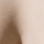 [19] (혐주의)<b>가슴</b>에 튼<b>살</b> 나만있냐...