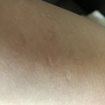 [댓글부탁해] 나만 <b>불주사</b> 자국 아직도 개진하냐..