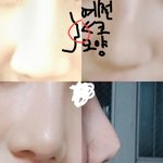 [댓글부탁해] 코성형 꿀팁(필독!!>성형계획시)