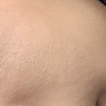 얘들아 나 피부 안좋은데 도와줘 ㅠㅠ