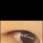 [댓글부탁해] 나 쌍수 <b>전후</b> 어때?