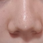 블랙<b>헤드</b>없애는법좀...ㅅㅂ