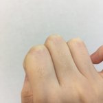 손 털 어떡해 ㅜㅜㅜ ?