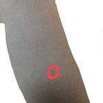 [댓글부탁해] 제모하면 이런거 왜생기는<b>거여</b>
