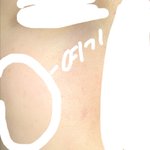 나 볼 옆쪽만지면 귀에 <b>압력</b> ㅈㄴ쎄게받는 느낌남