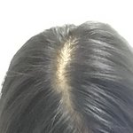 나 <b>탈모</b>같아?