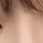 [이것좀봐줘] 쌍수할건데 나좀 도와줘 ㅜㅜ