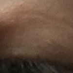 [댓글부탁해] 나 쌍수했는데 <b>염증</b>