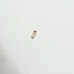 [댓글부탁해] <b>극혐</b>주의)야 내 귀에서 이거 나왔는데 머임