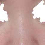 나 섀딩으로 코 <b>커버</b> <b>가능</b>해?