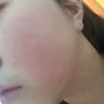 [드루와] 나 피부좋은데 <b>홍조</b>개심해