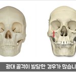 <b>동양인</b> 골격이 좀 더 귀엽다