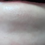 액혐) 이런 <b>피지</b> 껴있는 거 ㄹㅇ 어떡하냐