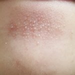 [댓글부탁해] 징그러움 주의) <b>턱</b> 밑 우둘<b>투</b>툴한 거 이거 뭘까 진짜....