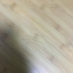 나 <b>탈모</b> 맞지 ㅈ됨 ㅅㅂㅅㅂㅅㅂㅅㅂ