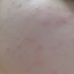 아 피부 어떡해 <b>흐엉</b>(약혐) 도와줘ㅠㅠ