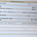 [10대의성] 서로 <b>입술</b>만 빠는거