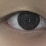[추반] 나 쌍수 하면 괜찮을거 같아?