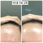 [드루와] <b>이명학</b>!!!!! 듣는 사람 들어와봐!!!!!!!!