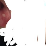 조카 아파 내 <b>구내염</b> 봐줘ㅠㅠㅠㅠㅠㅂ