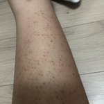[댓글부탁해] 나보다 <b>닭살</b>심한사람 못봄
