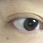 나 쌍수 붓기 덜빠진거야?