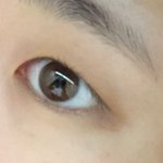 나두 쌍수 추반 해줘ㅠㅠㅠ