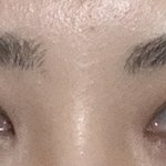 [댓글부탁해] 내 눈인데 딱 봐도 쌍수 했네 싶은 정도야??