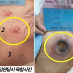 <b>요양</b>병원 코로나로 면회금지 기간동안 발생한 끔찍한일 (임산부 노약자...