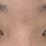[드루와] 쌍수하면 잘될눈임??