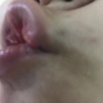 [댓글부탁해] 입술옆에 <b>색소</b>침착 개심해 ;;