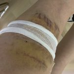 [이것좀봐줘] 개물림사고/대형견사고/형사합의/<b>민사</b>소송