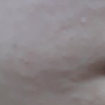 혐주의!! 내 <b>좁쌀</b> 변화 봐봐