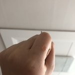 화상 <b>물집</b> 언제 없어지는지 아는 사람?