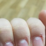 [댓글부탁해] <b>손톱</b>에 이거 뭐야?????