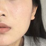 혐주의 여드름피부들아 <b>파데</b> 추천함ㄹㅇ