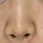 [댓글부탁해] 코 옆 <b>나비존</b>에 나는건 머임?