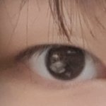 나 <b>눈지방</b> 많지 않아?