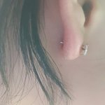 나 왼쪽 귓불 <b>조나</b> 부었는데 왜이래