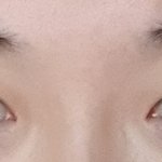 나 <b>쌍수</b>하는거 어떨거 같아