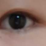 <b>속쌍</b>?인데 쌍수할까