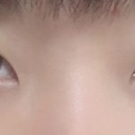 [드루와] 내 쌍수 <b>전후</b> 역대급임 ㄹㅇ