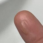 [댓글부탁해] 사진ㅇ)나 손에 <b>물집</b> 이거 터트릴까?