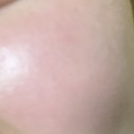 와 나 피부 <b>홍조</b>있는거 치곤 좋지 않냐